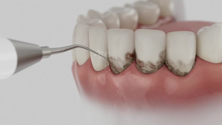 Reliable Dental Implants contractor in Raytown, MO by Smile Center Dentistry